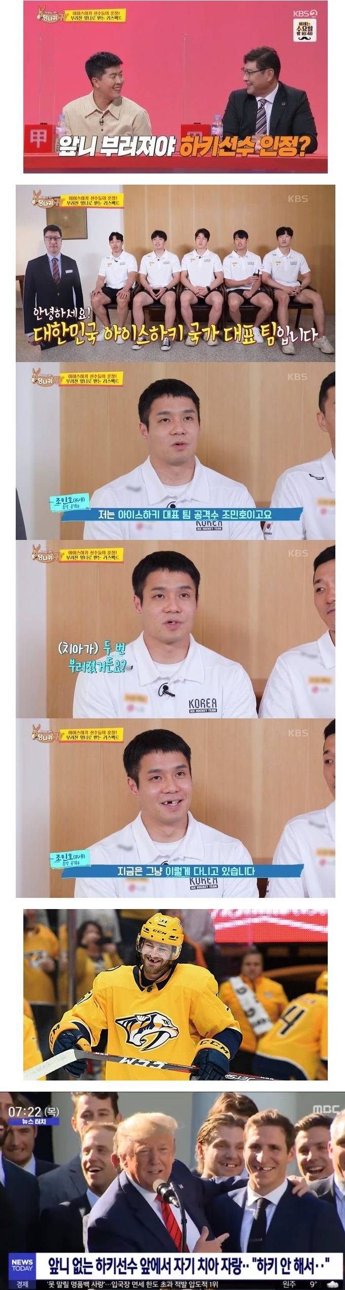 하키 선수들 앞니가 없는 이유