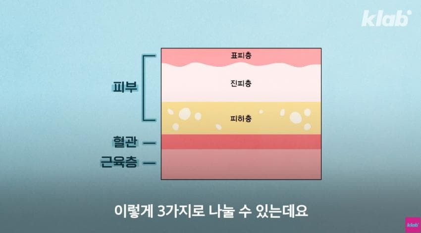 외국에서는 안 맞는다는 엉덩이 주사