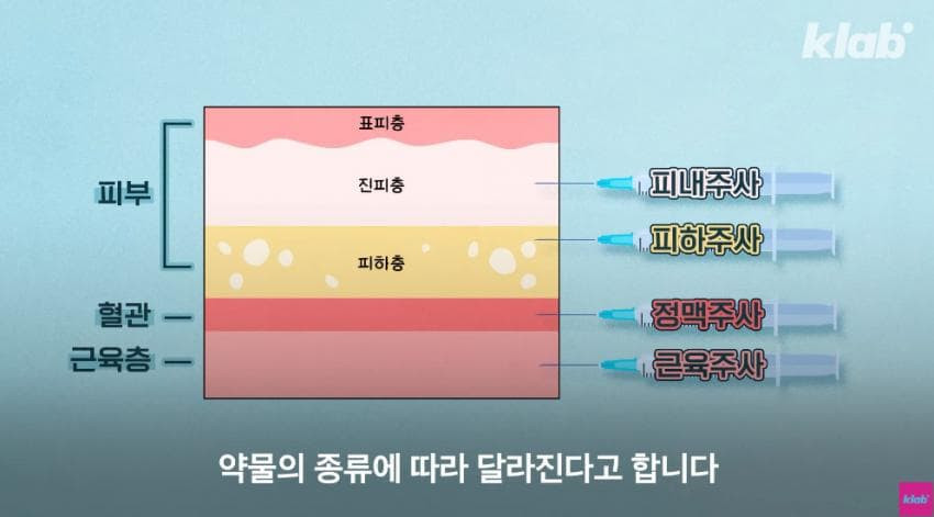 외국에서는 안 맞는다는 엉덩이 주사