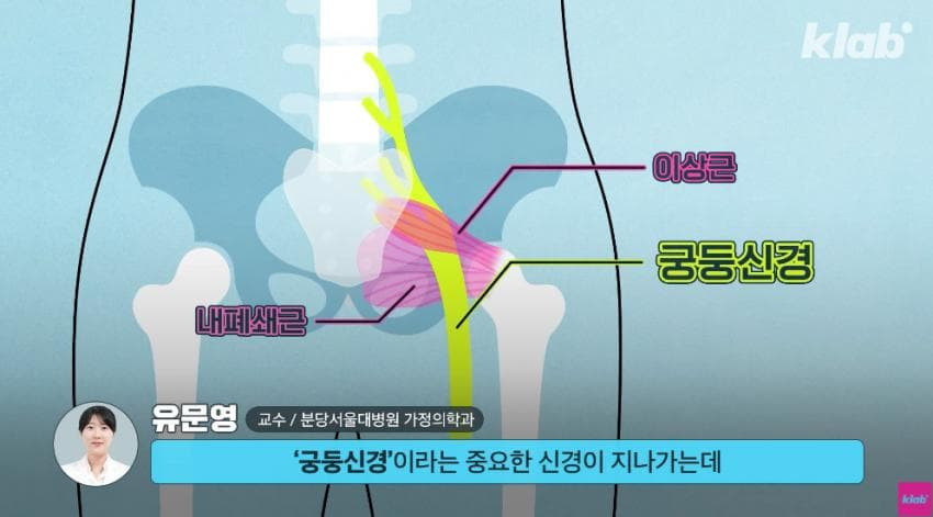 외국에서는 안 맞는다는 엉덩이 주사