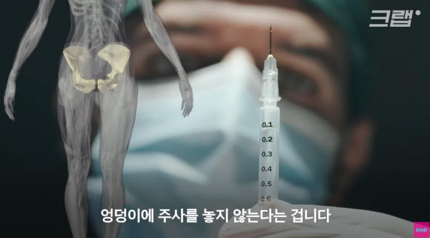 외국에서는 안 맞는다는 엉덩이 주사