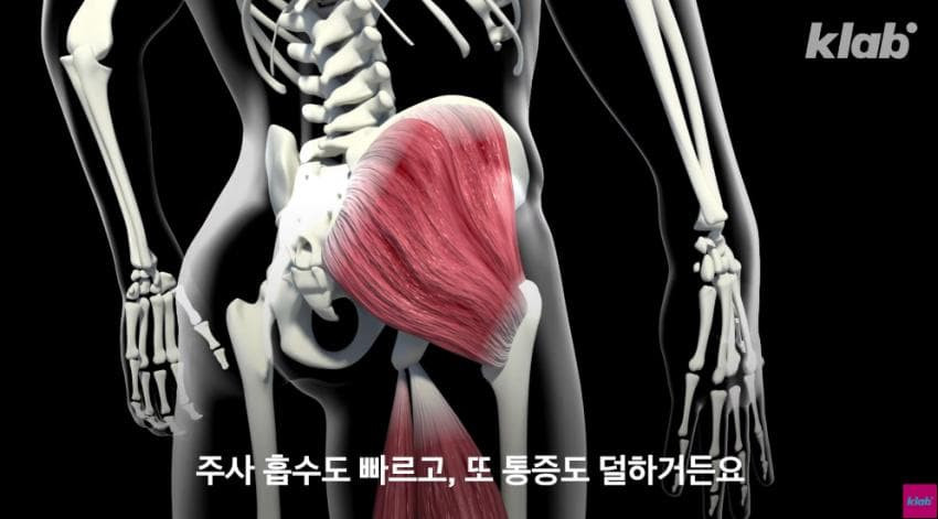 외국에서는 안 맞는다는 엉덩이 주사