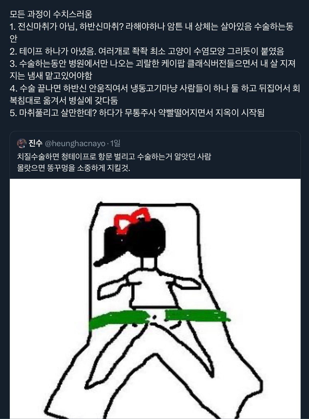 똥꼬를 소중히 여겨야하는 이유