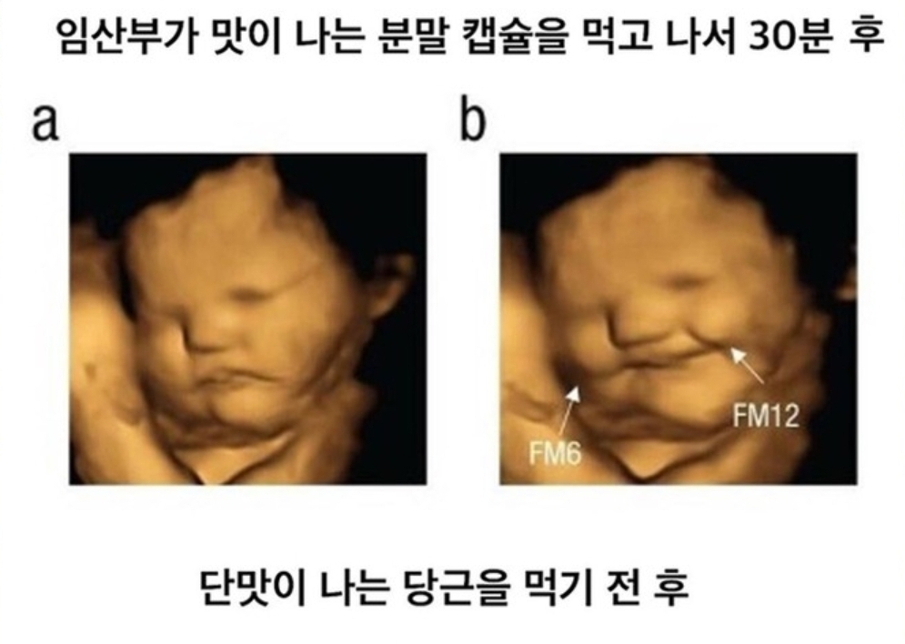 임신했을 때 아기가 먹고싶어한다는 말이 맞나봄