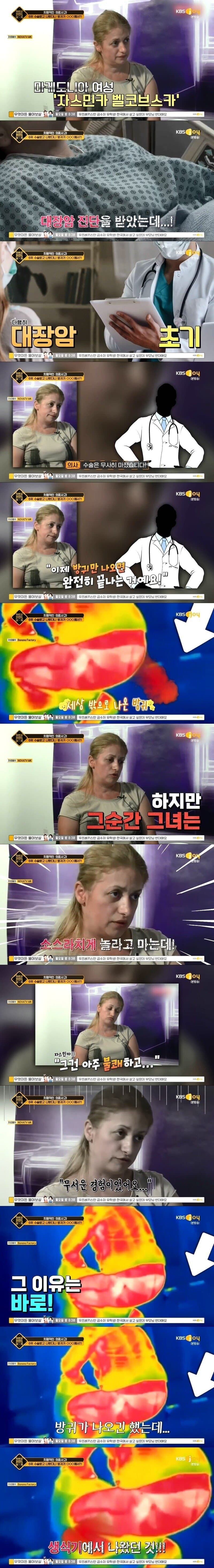 수술하고 나왔더니 엄청난 부작용이 발생한 여성.jpg