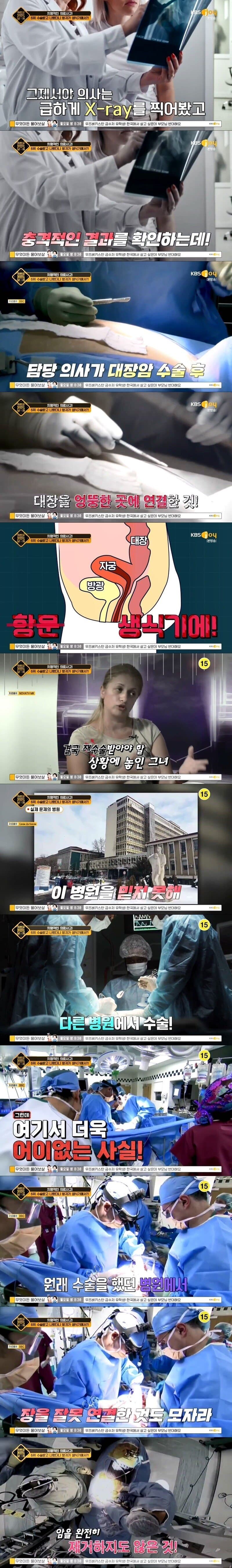 수술하고 나왔더니 엄청난 부작용이 발생한 여성.jpg