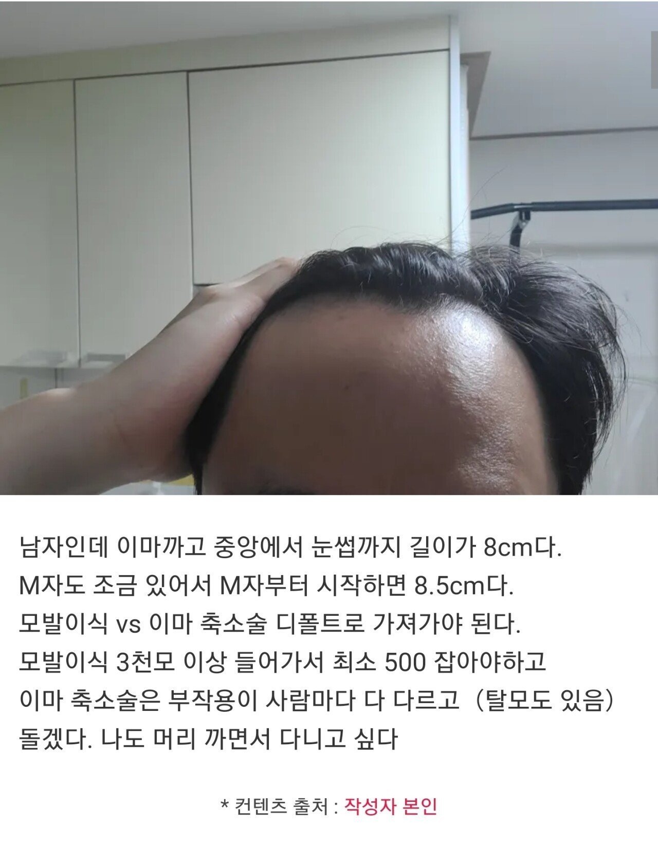 이마 8cm다...자괴감든다....jpg