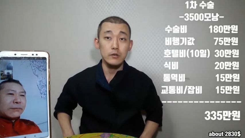 모발이식하려면 무조건 터키를 가야 하는 이유