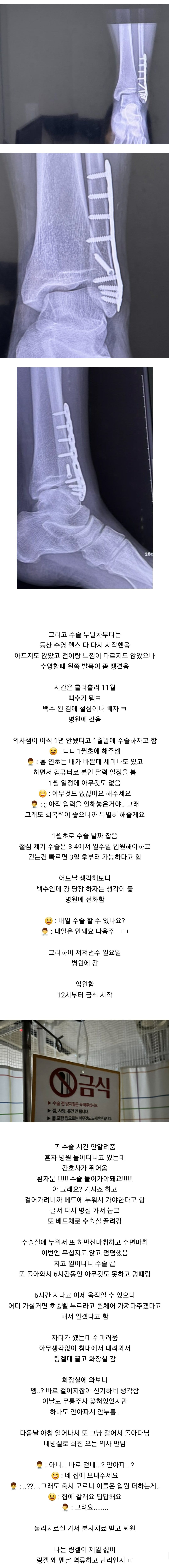 어느 건강하고 회복력 아주 좋은 쾌녀의 발목뼈 부러진 후기