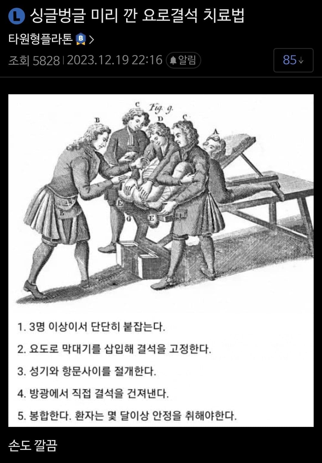 공포공포 옛날 요로결석 수술법