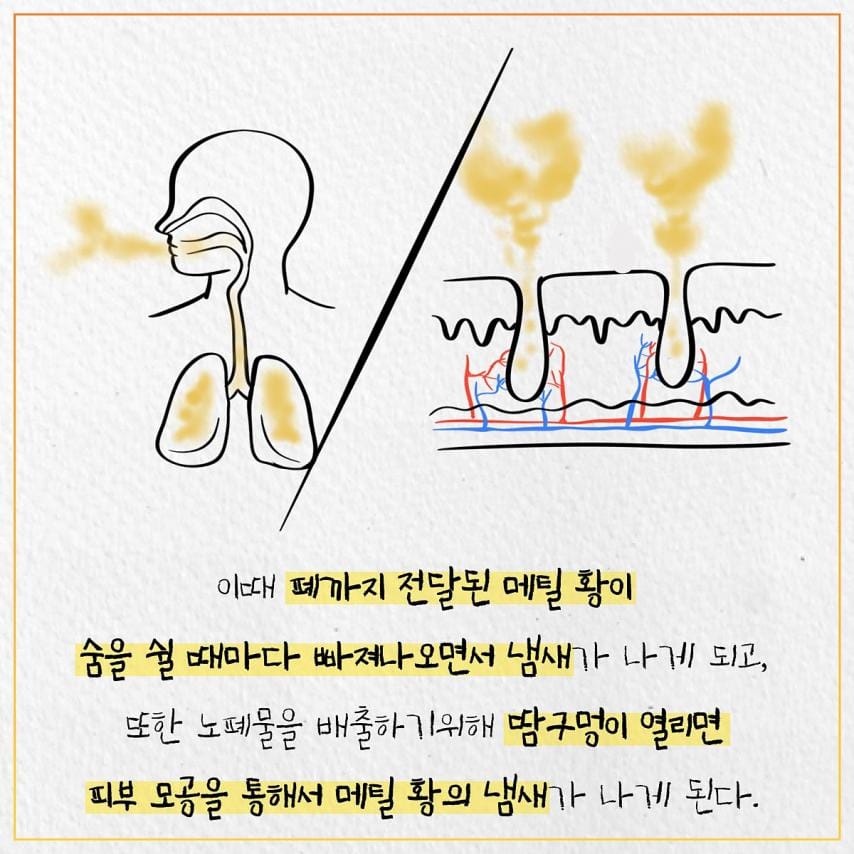 한국인들에게 마늘 냄새가 난다고 하는 이유.jpg