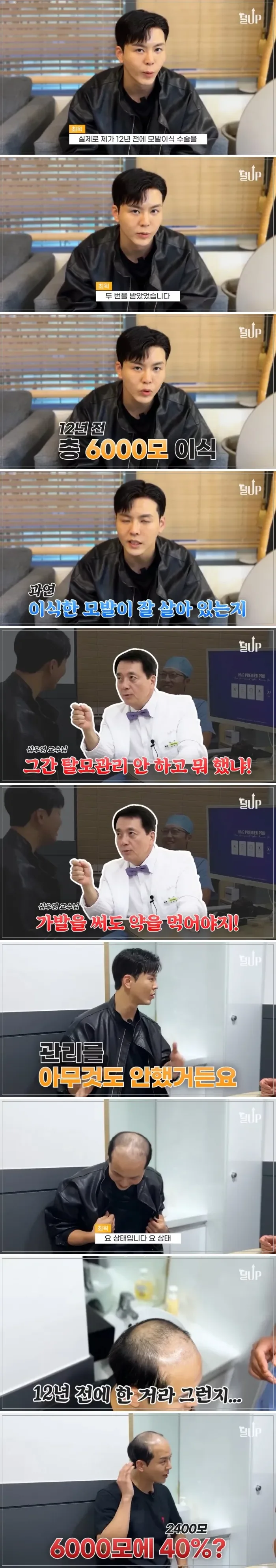 모발이식 12년 후 근황.jpg