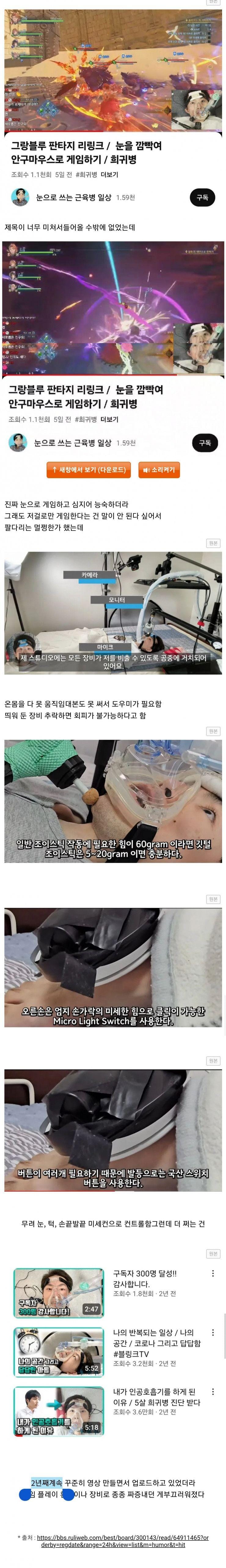 눈으로 게임하는 희귀병 게이머