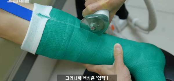 왜 깁스는 위험하게 전기톱으로 자를까?.jpg