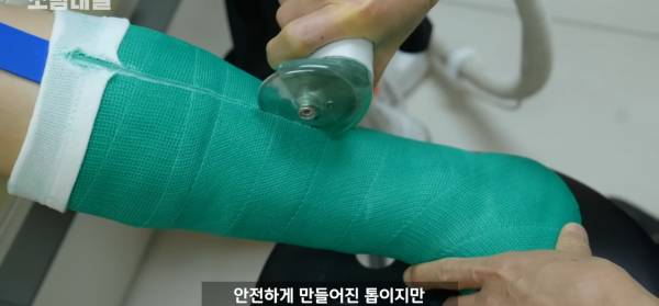 왜 깁스는 위험하게 전기톱으로 자를까?.jpg