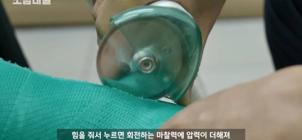 왜 깁스는 위험하게 전기톱으로 자를까?.jpg