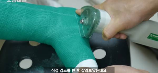 왜 깁스는 위험하게 전기톱으로 자를까?.jpg