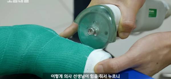 왜 깁스는 위험하게 전기톱으로 자를까?.jpg