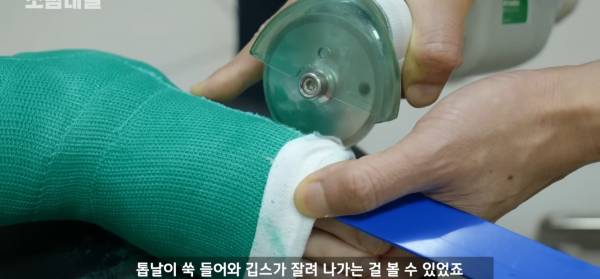 왜 깁스는 위험하게 전기톱으로 자를까?.jpg