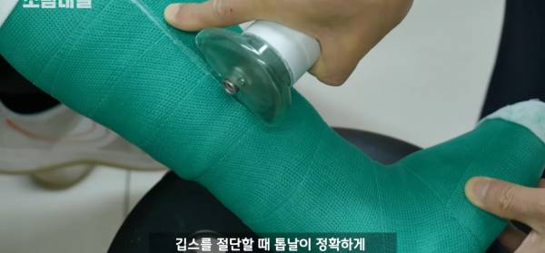 왜 깁스는 위험하게 전기톱으로 자를까?.jpg