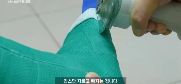 왜 깁스는 위험하게 전기톱으로 자를까?.jpg