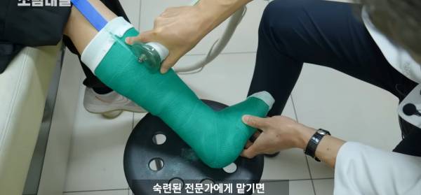 왜 깁스는 위험하게 전기톱으로 자를까?.jpg