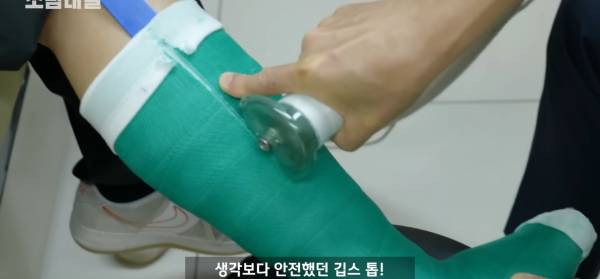 왜 깁스는 위험하게 전기톱으로 자를까?.jpg