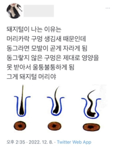 정수리에 돼지털(지랄머리)나는이유