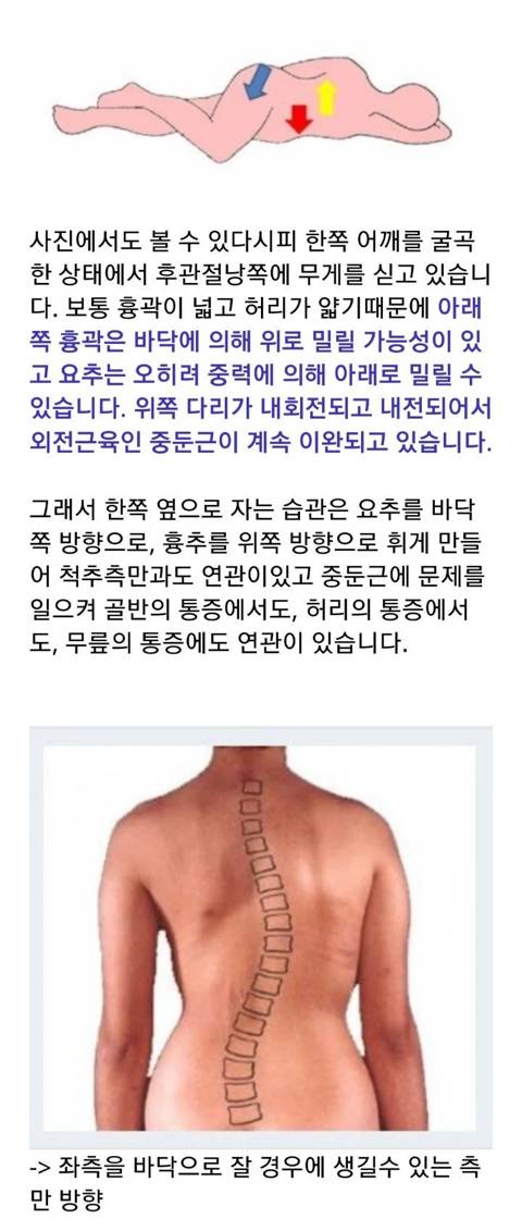 허리 척추 골반 한번에 아작나는 자세