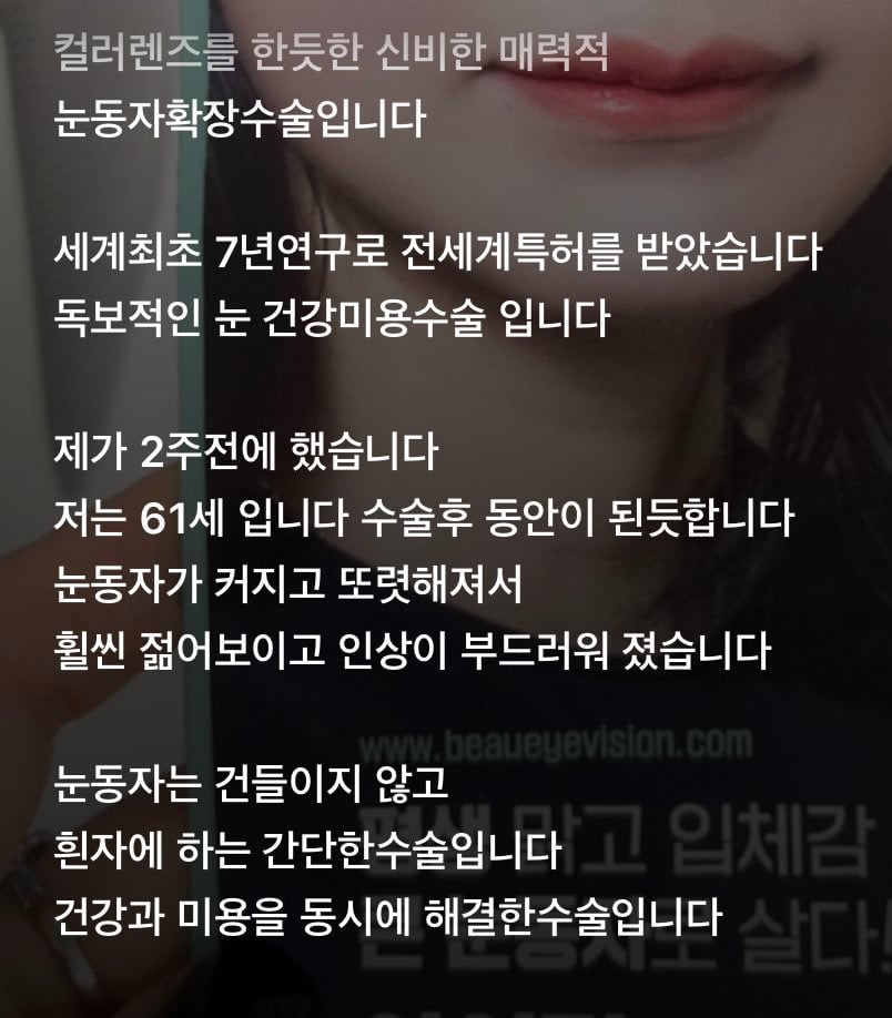 인스타에서 핫한 성형수술