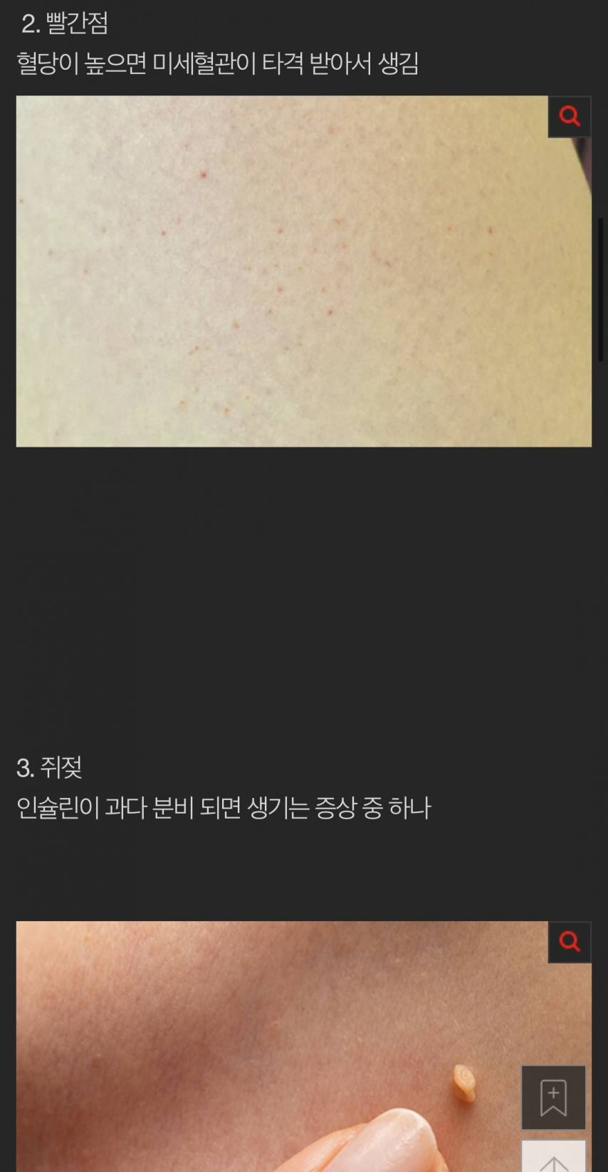 몸에 당수치가 높으면 생기는일들