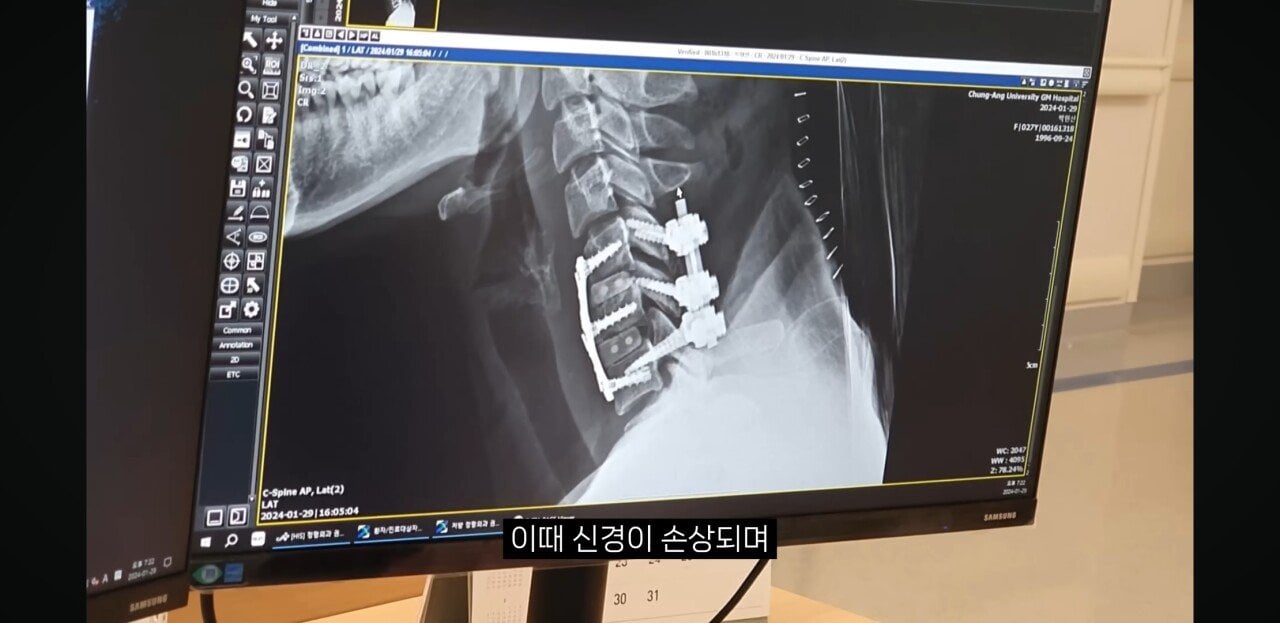 해외여행에서 단 1초만에 전신마비가 된 사람