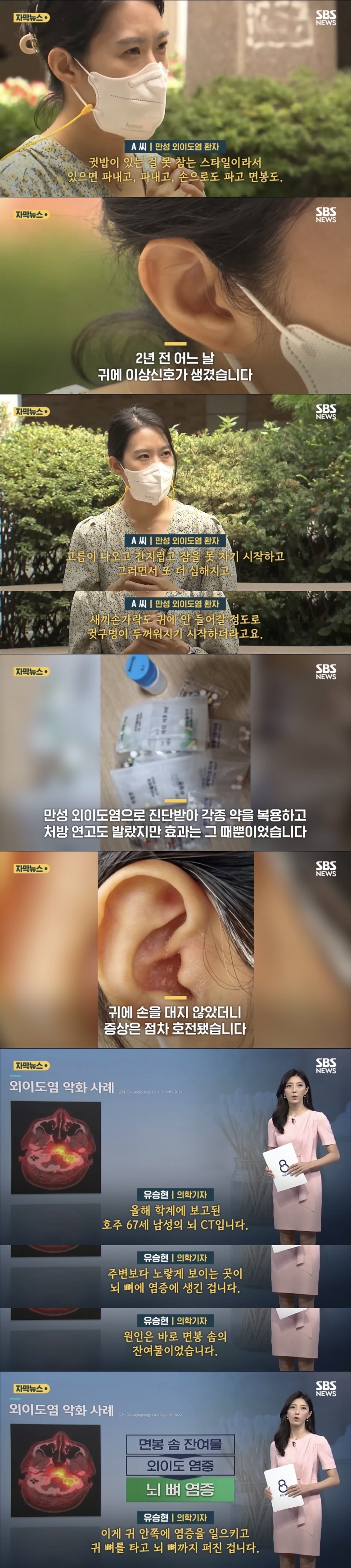 면봉으로 귀 파면 안되는 이유 jpg