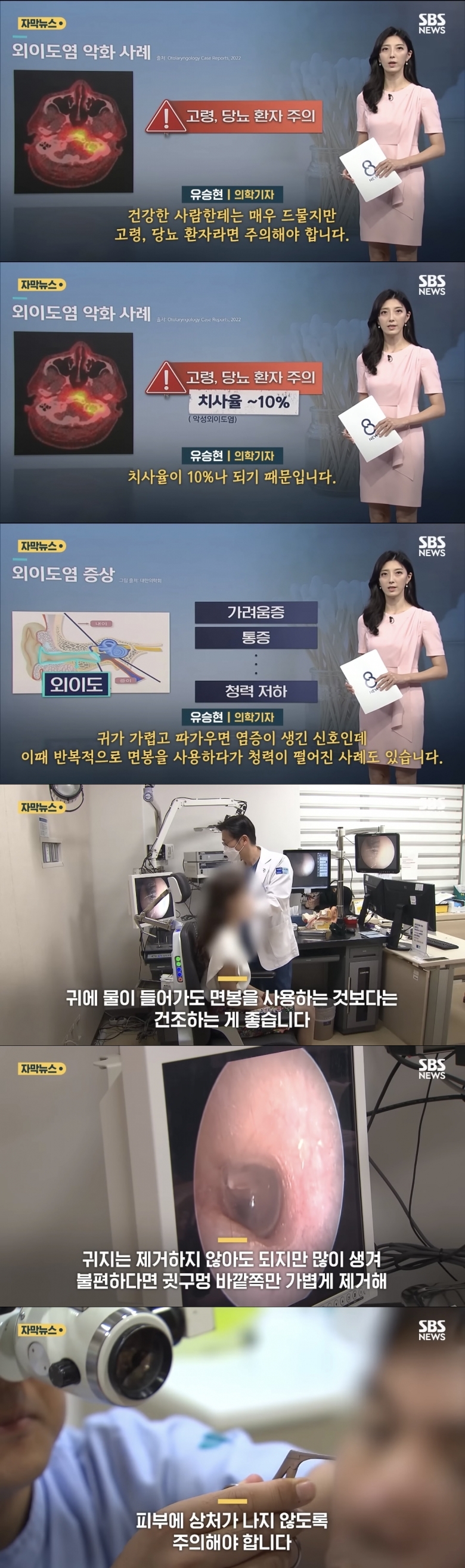 면봉으로 귀 파면 안되는 이유 jpg