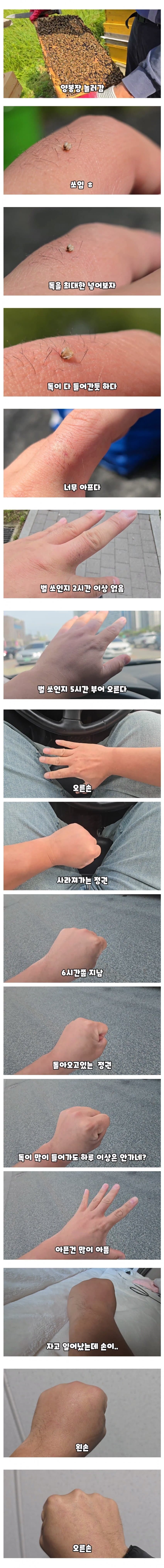 꿀벌한테 쏘인김에 꿀벌 독 끝까지 주입해보는 유튜버.jpg