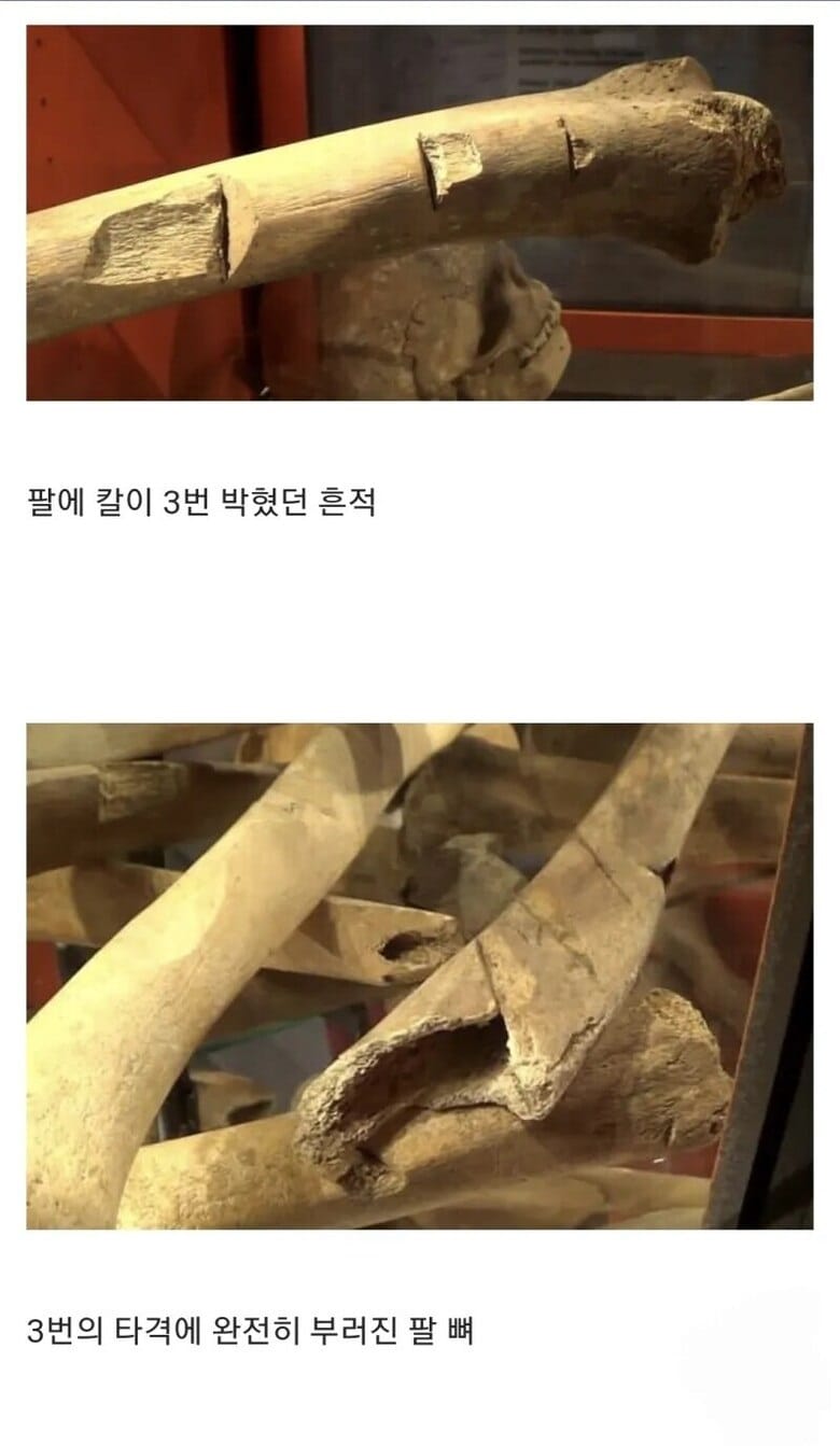 15세기 병사들의 유골들.jpg