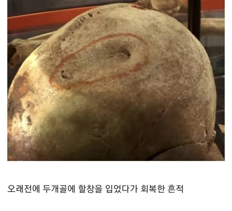 15세기 병사들의 유골들.jpg