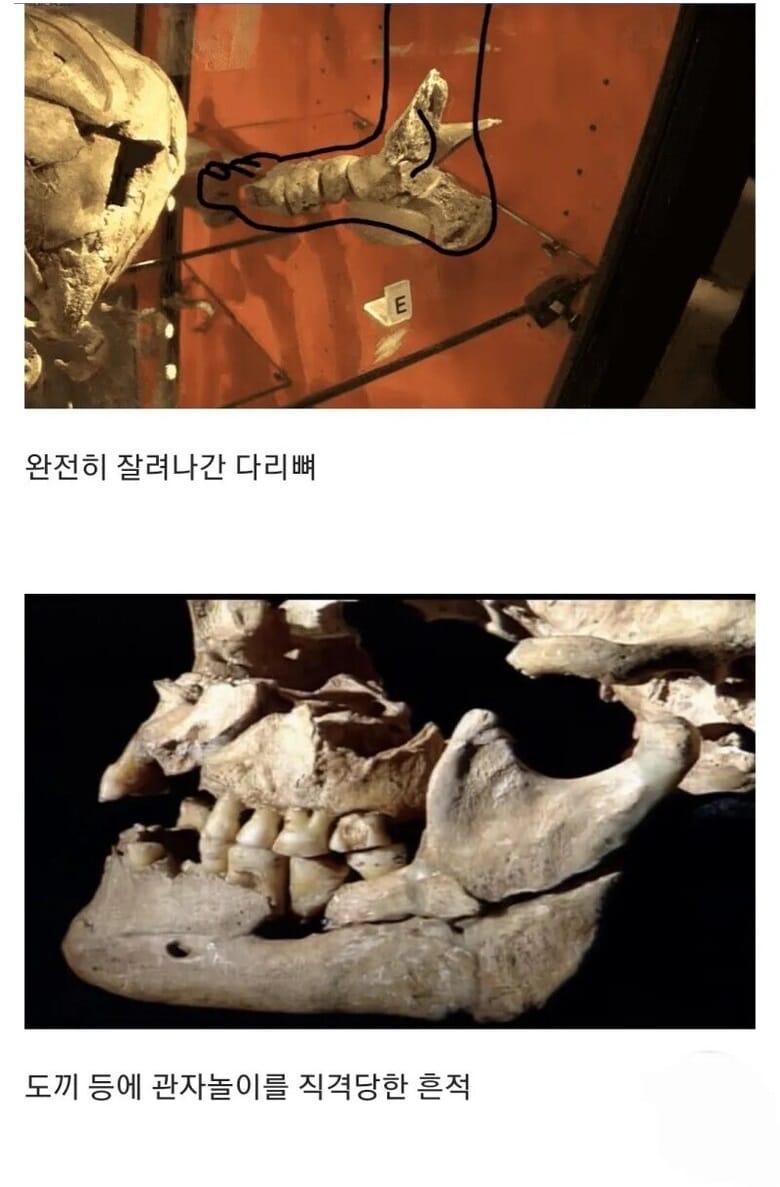15세기 병사들의 유골들.jpg