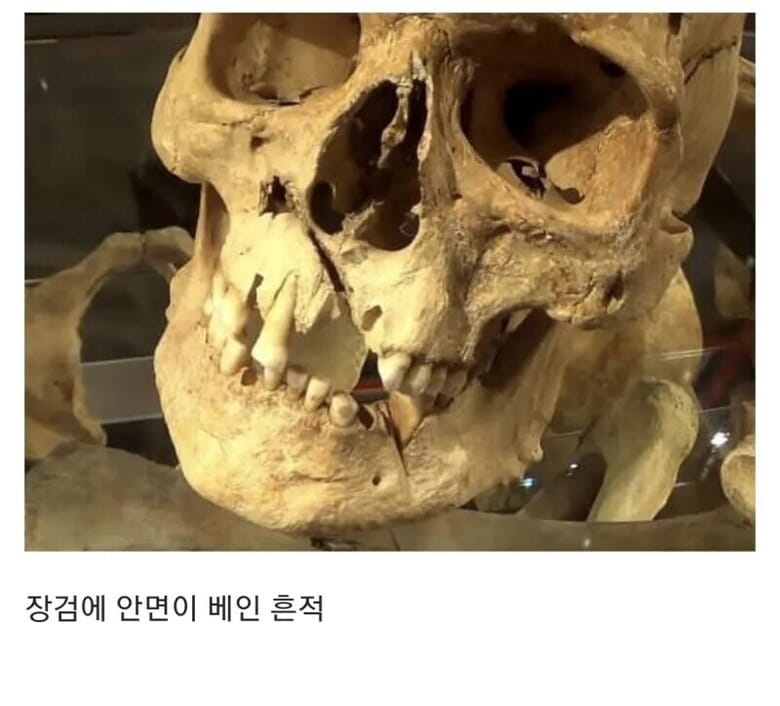 15세기 병사들의 유골들.jpg