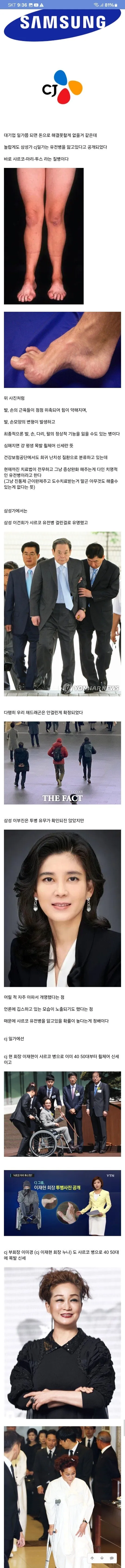 삼성과 CJ 가문의 유전병.jpg