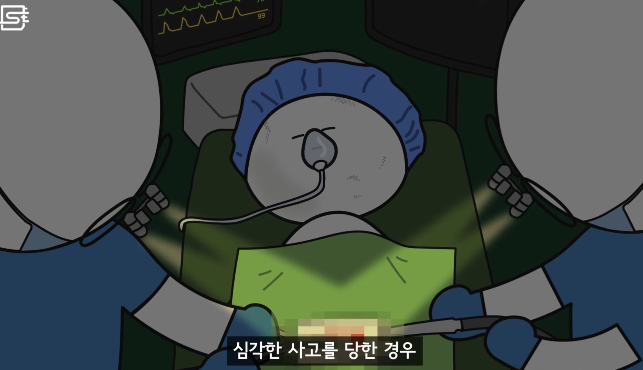 렌즈 낀 상태에서 기절해 병원에 실려오면 어떻게 될까?