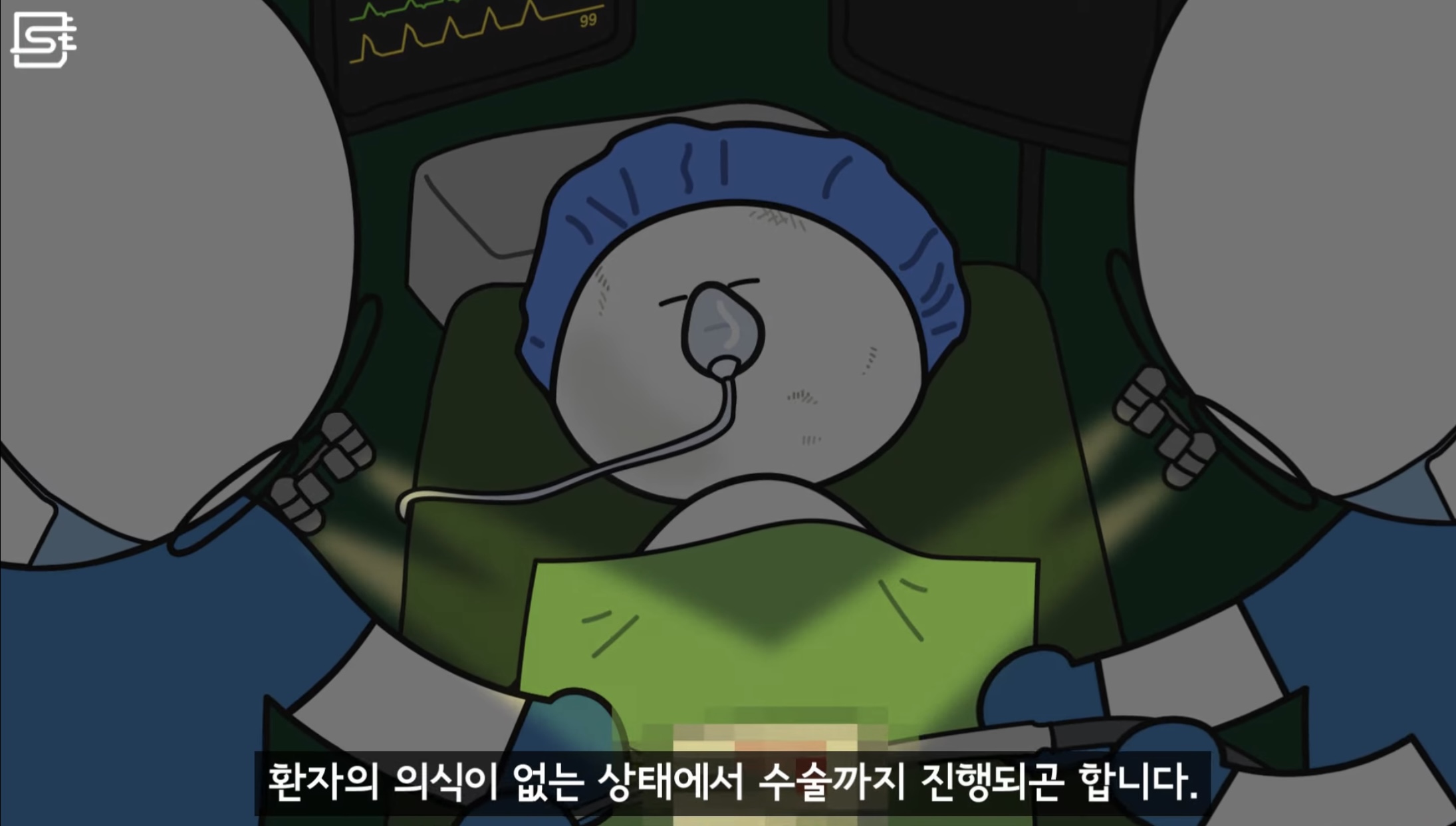 렌즈 낀 상태에서 기절해 병원에 실려오면 어떻게 될까?