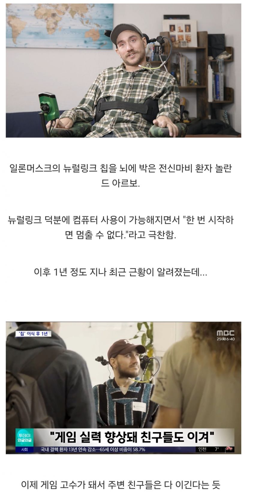 뇌에 뉴럴링크 칩을 박은 전신마비 환자 근황