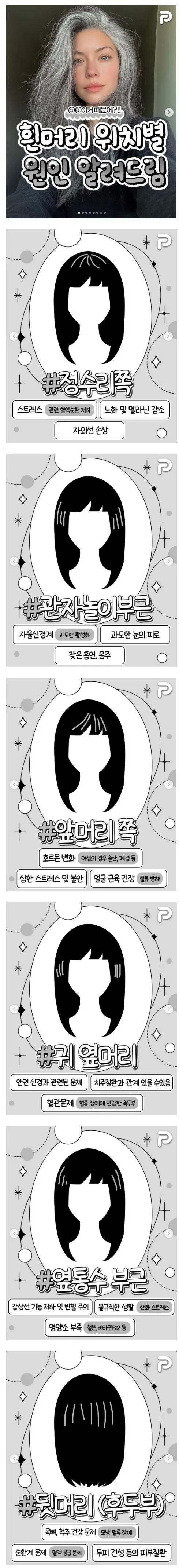 흰머리 위치별 원인