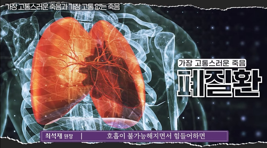 				인간이 경험하는 가장 고통스러운 죽음.jpg