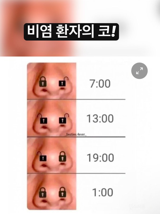 비염 환자의 코