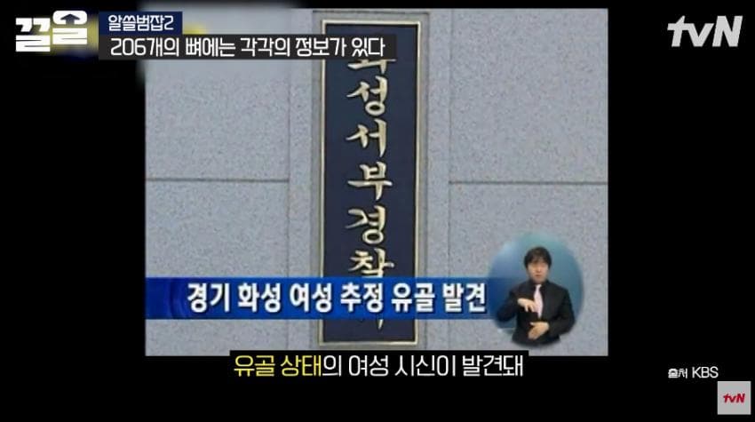 안면윤곽술을 받아야 하는 이유