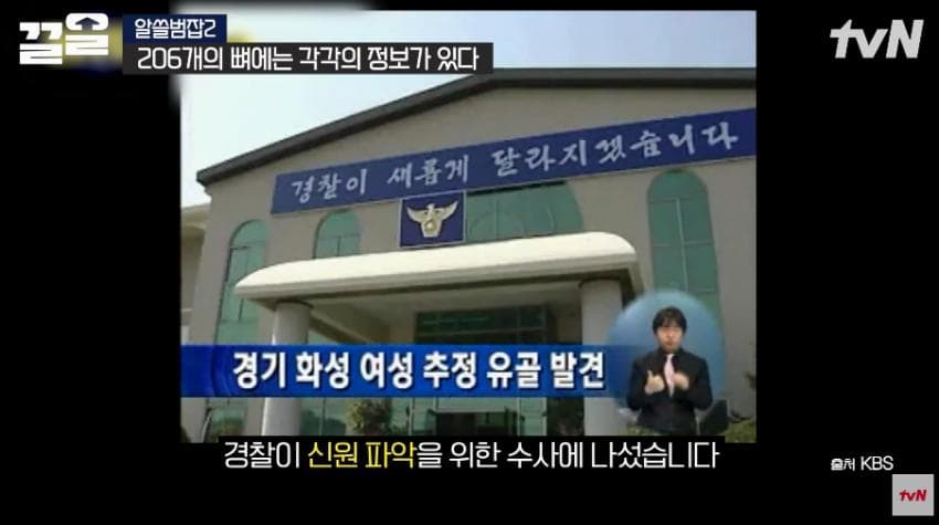 안면윤곽술을 받아야 하는 이유