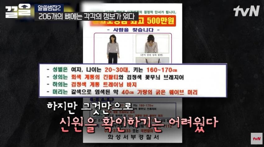 안면윤곽술을 받아야 하는 이유