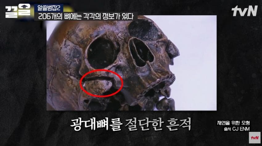 안면윤곽술을 받아야 하는 이유